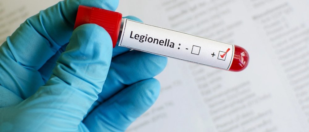 Legionella, czyli choroba legionistów. Jak się przed nią uchronić?