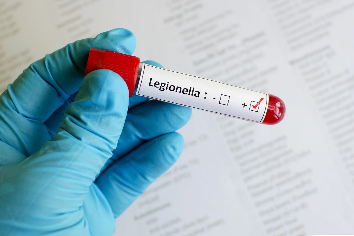 Probówka z pozytywnym wynikiem na Legionellę Probówka z pozytywnym wynikiem na Legionellę